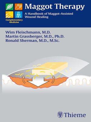 cover image of Maggot Therapy
